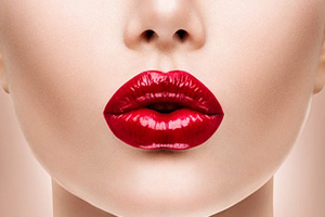 kiss-1